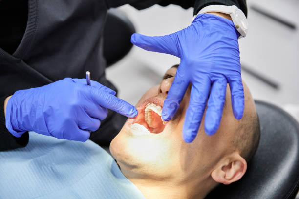 Best Emergency Dental Care for Broken or Chipped Teeth in Truman, MN